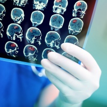 Iron-based Organic Polyhedra as MRI Contrast Agents for Glioma Imaging. 