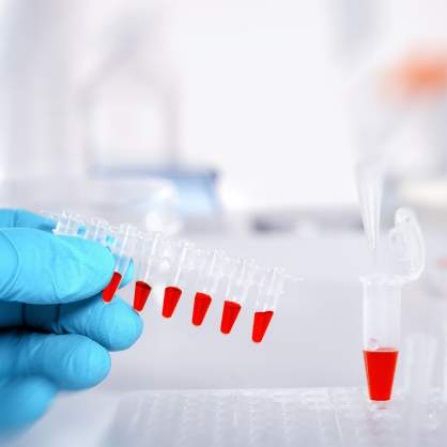 Neurovascular Diagnostics. 